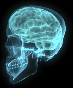 Deep Brain Stimulation for Cluster Headache