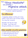Your sinus headache was probably a migraine attack