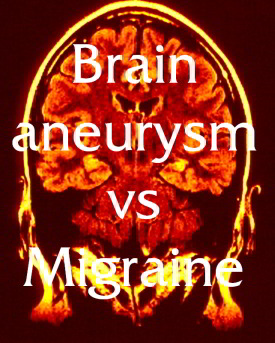 Migraine vs Brain Aneurysm