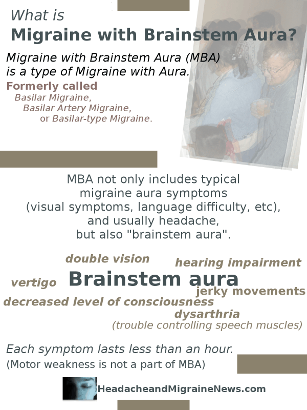 Migraine with Brainstem Aura