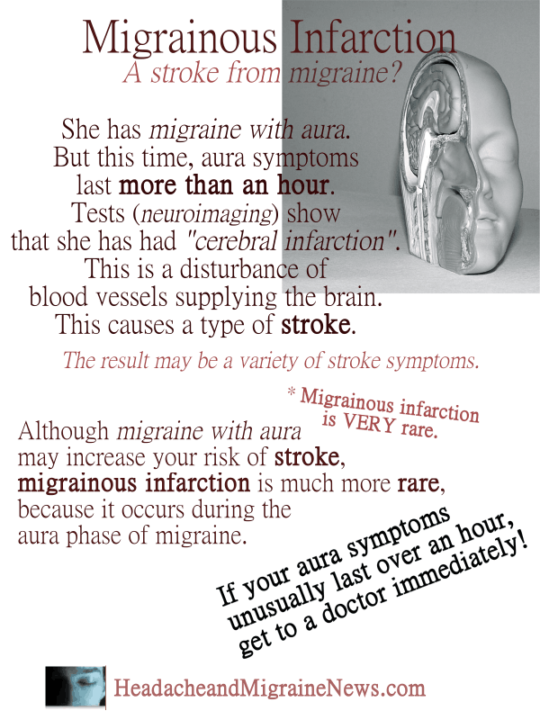 Migrainous Infarction - Stroke from Migraine?