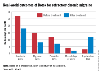 botox-for-migraines-khalil