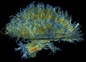 The white matter structure of a human brain (MRI image)