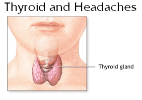 Thyroid Headache