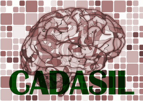 CADASIL and Migraine