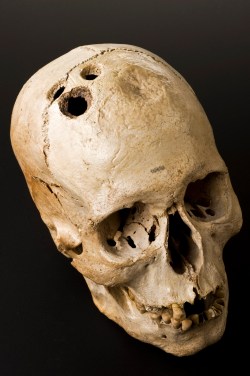 Skull from a tomb in Jericho