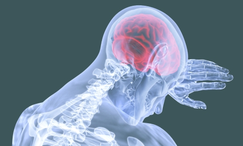 Traumatic Brain Injury Headache