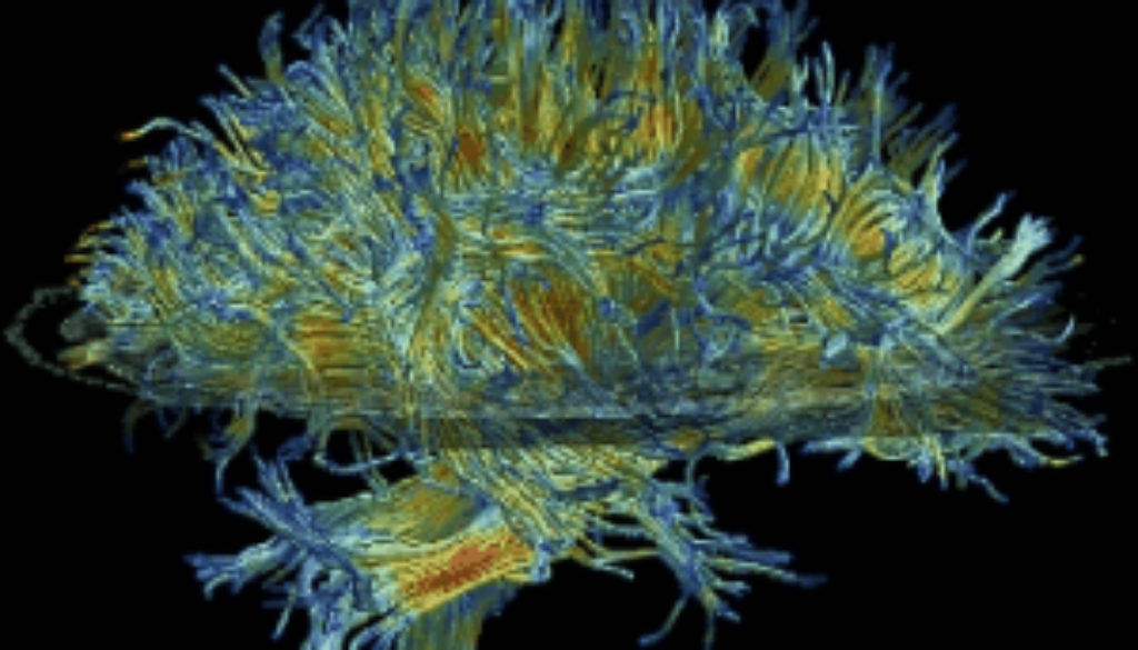 The white matter structure of a human brain (MRI image)